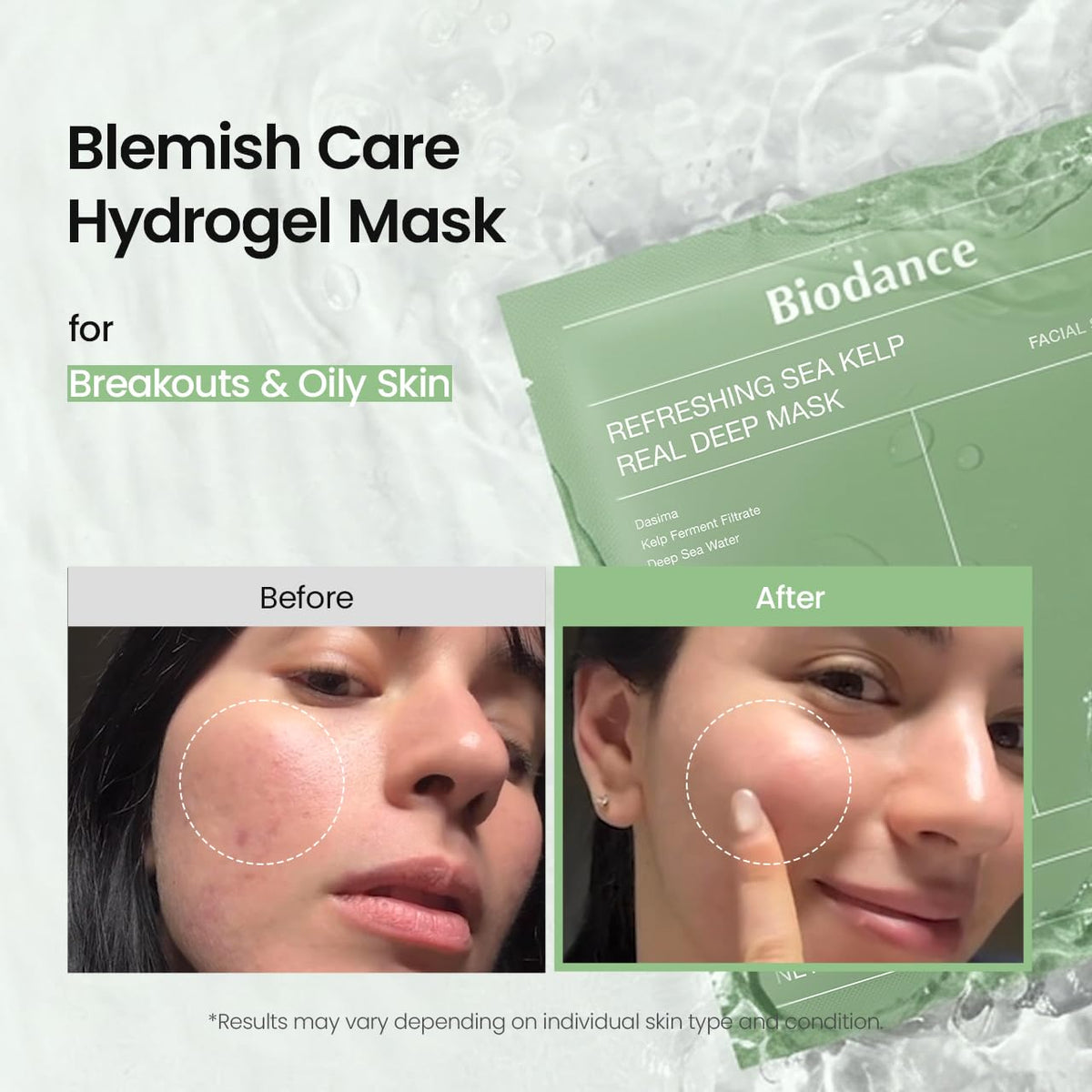 BIODANCE Refreshing Sea Kelp Real Deep Mask, Hydrogel Mask, Calming, Oil & Sebum Control, Blemish Care, Korean Skincare, 34 g x 4ea
