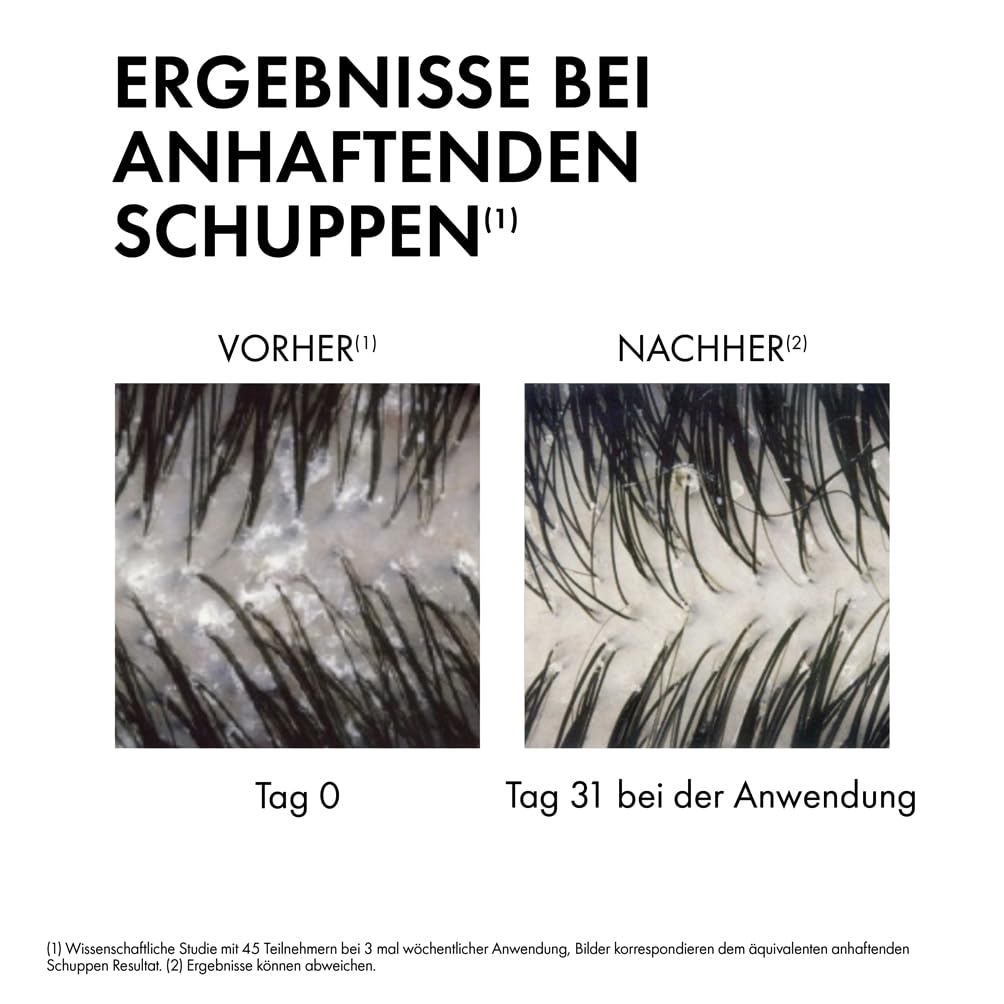 Vichy Dercos Anti-Schuppen Shampoo für fettige Kopfhaut