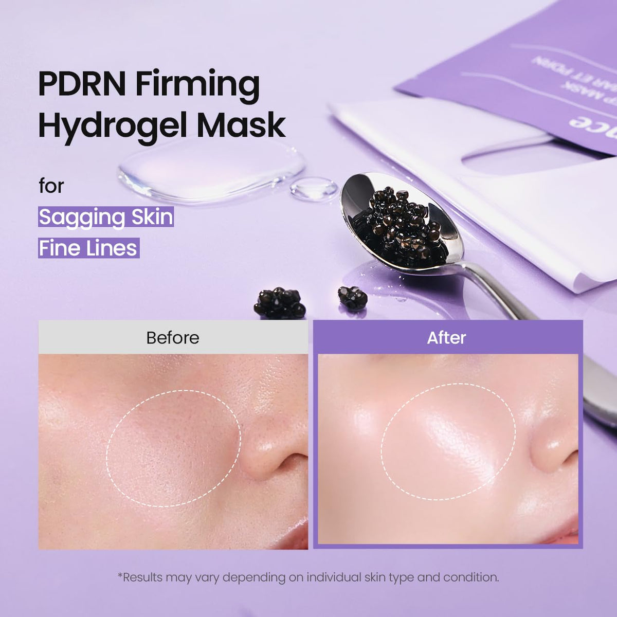 BIODANCE Refreshing Sea Kelp Real Deep Mask, Hydrogel Mask, Calming, Oil & Sebum Control, Blemish Care, Korean Skincare, 34 g x 4ea
