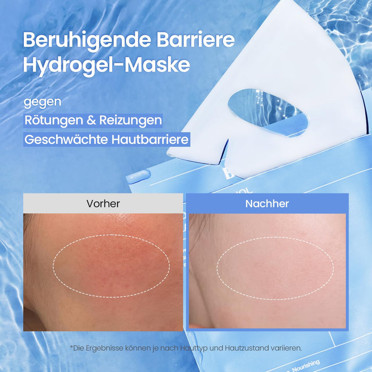 BIODANCE Refreshing Sea Kelp Real Deep Mask, Hydrogel Mask, Calming, Oil & Sebum Control, Blemish Care, Korean Skincare, 34 g x 4ea