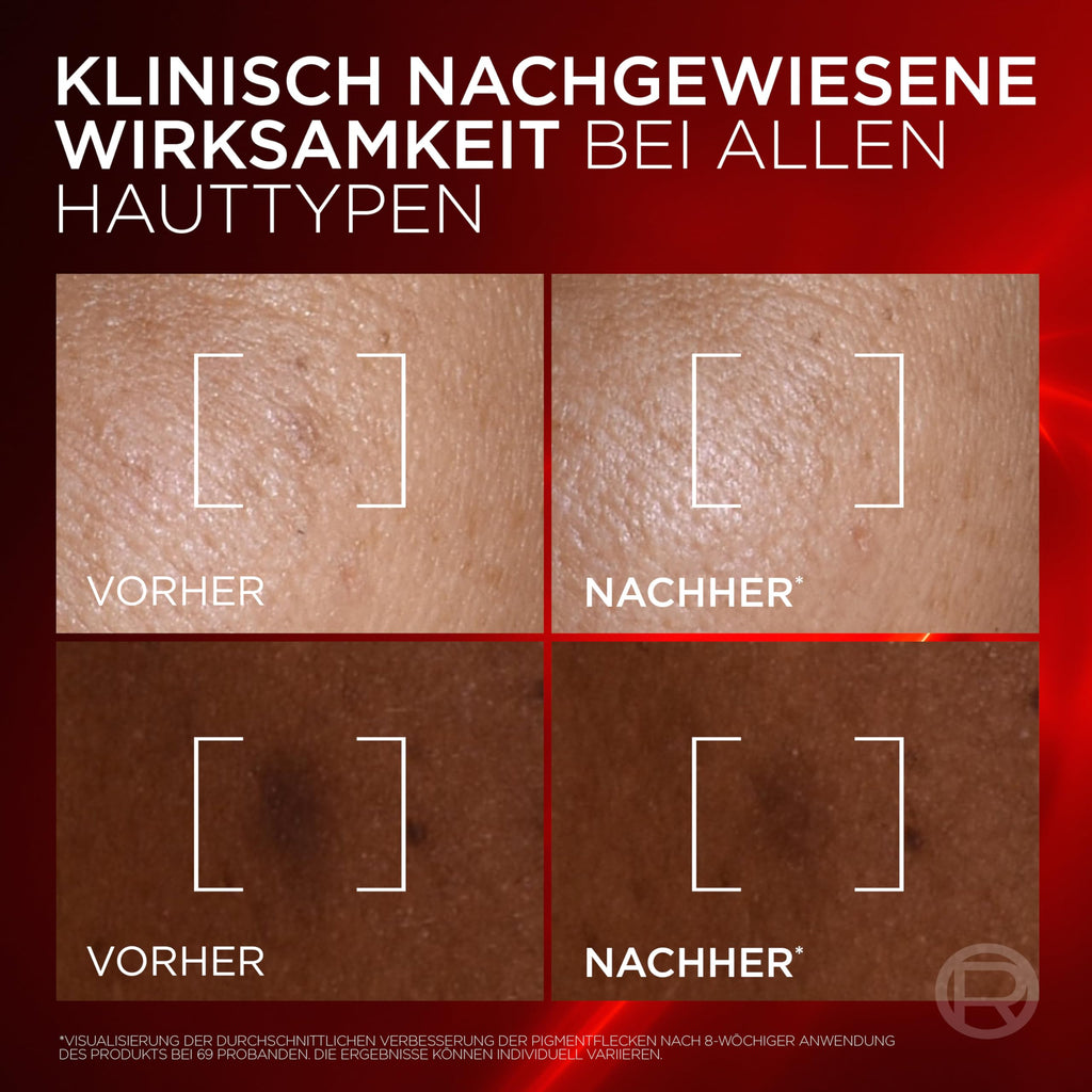 L'Oréal Paris Anti-Aging,Tagescreme gegen Falten, straffend, 50 ml
