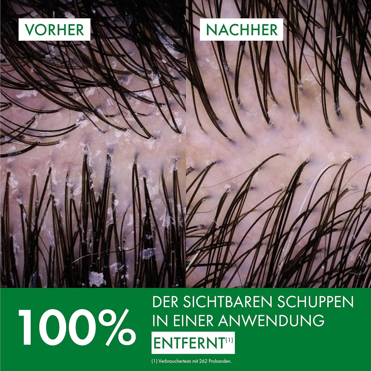 Vichy Dercos Anti-Schuppen Shampoo für fettige Kopfhaut