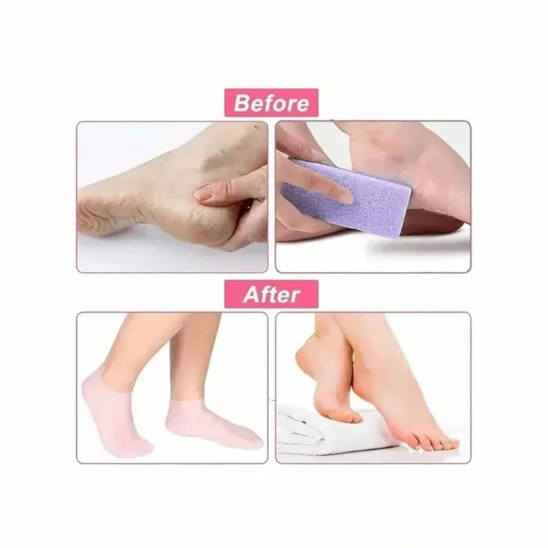 Moisturizing Silicone Foot Socks for Dry And Cracked Feet Women's Comfortable Moisturizing Socks Featuring Deep Moisture Therapy